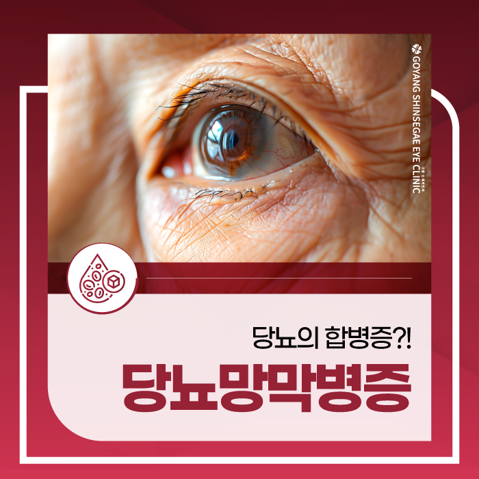 은평안과 당뇨 때문에 눈에 합병증이 생길 수 있다?