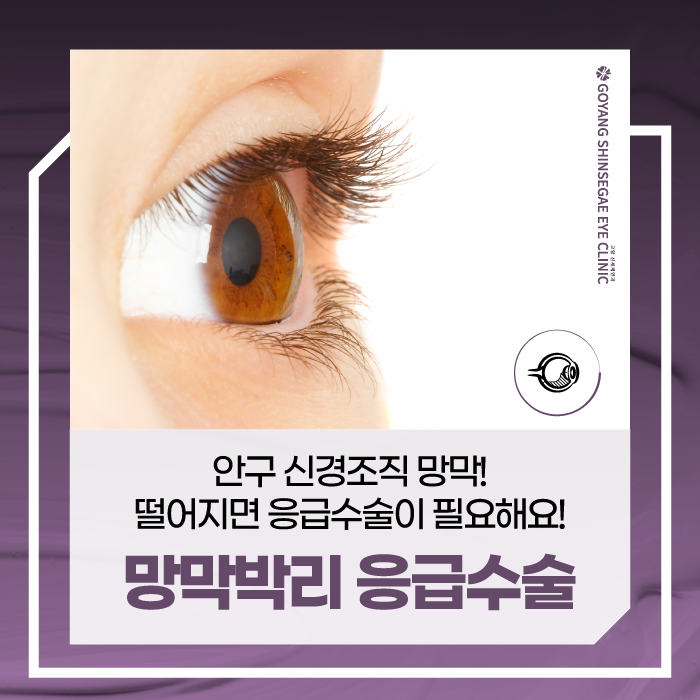 구파발역안과 망막 떨어지면 응급수술이 필요할까?